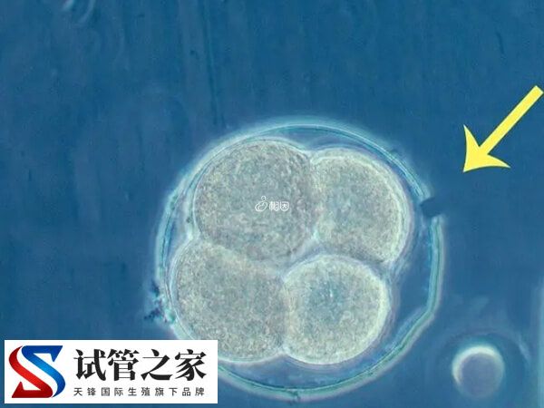 什么叫人體胚胎孵化項目